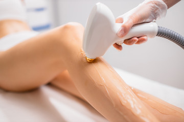Risks and Side Effects of Laser Hair Removal